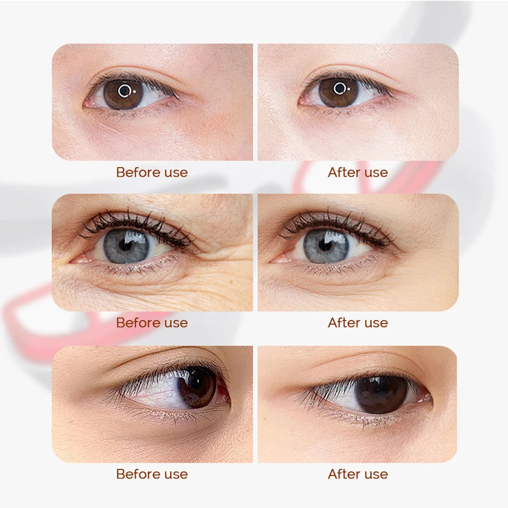 3D Eye Beauty Massager Red Light Eye Fatigue Dark Circles Reduce Fine Lines Relax Massager Eye Care Device